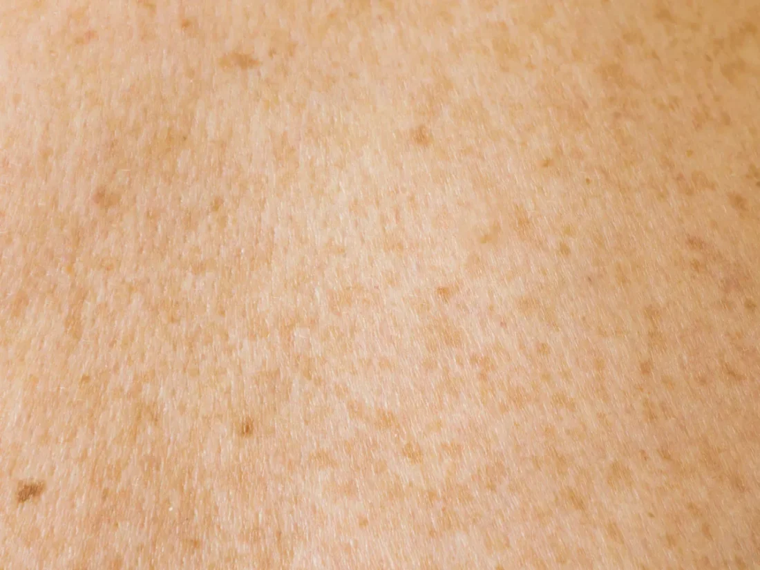 Närbild på hud textur