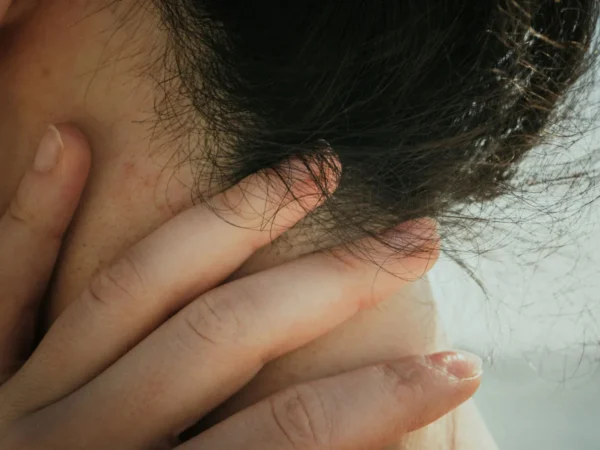 Mjälleksem (Seborroiskt eksem)